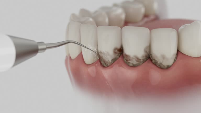 Trusted Tooth Extraction service in St. Charles, IL - Dentist Open Now